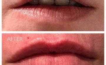 Compare Reviews, Prices & Costs of Dermatology in West Yorkshire at Dr. Gabriela Aguilar - Leeds | M-UN1-1059