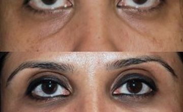 Compare Reviews, Prices & Costs of Cosmetology in Johannesburg at The Face and Body Place | M-SA2-6