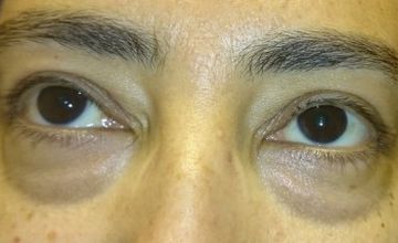 Compare Reviews, Prices & Costs of Ear, Nose and Throat (ENT) in Egypt at Dr. Ashraf Abolfotooh Plastic & Reconstructive Surgery Clinic | M-EG1-94