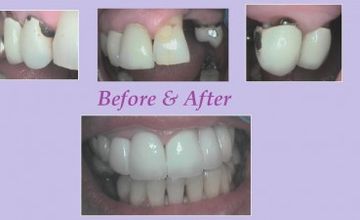 Compare Reviews, Prices & Costs of Plastic and Cosmetic Surgery in West Midlands at Lion Dental Centre | M-UN1-1225