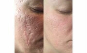 Compare Reviews, Prices & Costs of Plastic and Cosmetic Surgery in Worcestershire at Lolica | M-UN1-1243