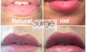 Compare Reviews, Prices & Costs of Plastic and Cosmetic Surgery in Cheshire at Surge Medical Aesthetics | M-UN1-1244