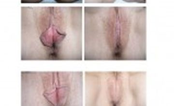 Compare Reviews, Prices & Costs of Oncology in West Yorkshire at GyneClinics @ Airedale NHS | M-UN1-1297