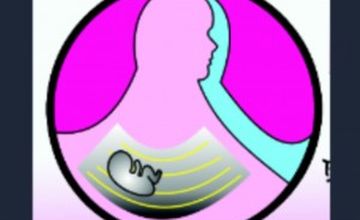 Compare Reviews, Prices & Costs of Diagnostic Imaging in Agusan del Norte at Lagro OB Gyn Ultrasound Clinic | M-P2-43