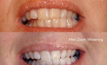 Compare Reviews, Prices & Costs of Dermatology in Nicosia at Cyprus Sun Med Connections | M-CY1-68