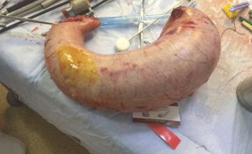 Compare Reviews, Prices & Costs of Gynecology in Cairo at Weightloss Clinic | M-EG1-132