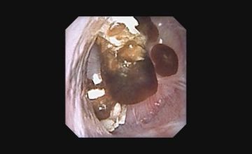 Compare Reviews, Prices & Costs of Urology in Selangor at Dr.Muhilan's Urology,Men's Health,Fertility and Stone Center | M-M2-95