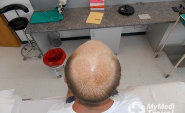 Compare Reviews, Prices & Costs of Nephrology in Cape Town at Medical Hair Restoration, Cape Town | 93915E