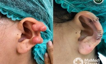 Compare Reviews, Prices & Costs of Ophthalmology in Chiang Mai at BK Clinic Chiang Mai | M-CM-38