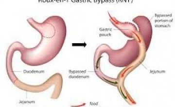 Compare Reviews, Prices & Costs of Gastroenterology in Delhi at Delhiobesityclinic | M-IN11-228