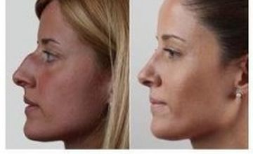 Compare Reviews, Prices & Costs of Cosmetology in Barcelona at Clínica Rinos | M-SP4-57