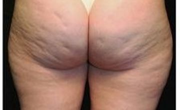 Compare Reviews, Prices & Costs of Laboratory Medicine in Portugal at Clínica Génese do Tempo, Lda | M-PP-1