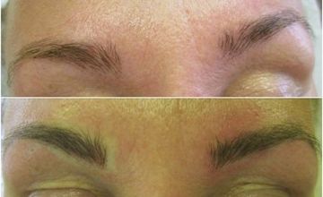 Compare Reviews, Prices & Costs of Cosmetology in Hertfordshire at Beauty Talk | M-UN1-2056