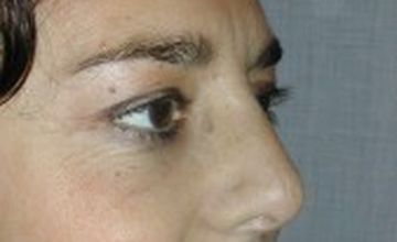 Compare Reviews, Prices & Costs of Cosmetology in Milan at Dr. Thomas Savoia | M-IT1-26