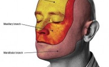 Compare Reviews, Prices & Costs of Physical Medicine and Rehabilitation in Lahore at Anwar Shah Trust for Cerebral Palsy and Paralysis | M-LP-6
