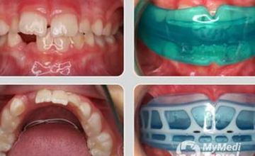 Compare Reviews, Prices & Costs of Dentistry in Agusan del Sur at Dr. Adelaida A. Oraiz | M-P3-1