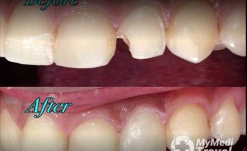 Compare Reviews, Prices & Costs of Dentistry in Camarines Norte at Confi-dent Family Dental Care | M-P19-2