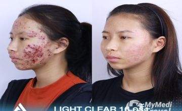 Compare Reviews, Prices & Costs of Dermatology in Chiang Rai at ATTITUDE CLINIC เชียงราย | DA576F
