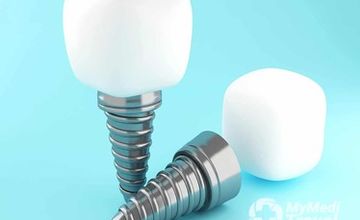 Compare Reviews, Prices & Costs of Dentistry in East at Pristine Dentalworks - Dental Specialist Singapore | 0A6831