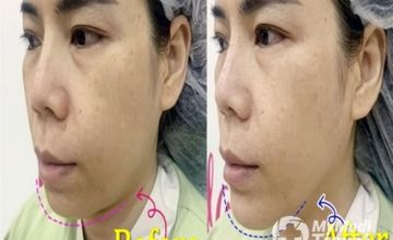 Compare Reviews, Prices & Costs of Cosmetology in Nonthaburi at Slaya Clinic | M-NB-140