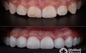 Compare Reviews, Prices & Costs of Neurosurgery in Brazil at Odontoliuzzi Brazilian Dental Clinic with Excellence | ADEE77