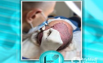 Compare Reviews, Prices & Costs of Hair Restoration in Armenia at United Hair Clinic | 2A79C4