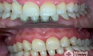 Compare Reviews, Prices & Costs of Physical Medicine and Rehabilitation in Greece at DUMITRIU DENT - Dr. Teodora Dumitriu | 755AEB