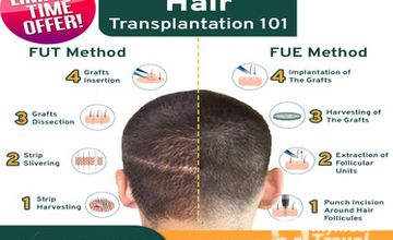 Compare Reviews, Prices & Costs of Physical Medicine and Rehabilitation in Cebu at Manzanares Hair Restoration Center | 7A7065