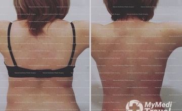 Compare Reviews, Prices & Costs of Gynecology in Ho Chi Minh City at Natural Aesthetics Plastic Surgery | A56BB9