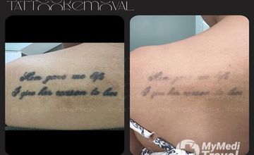 Compare Reviews, Prices & Costs of Urology in An Giang at PHU TON - Laser Tattoo Removal | B3369E