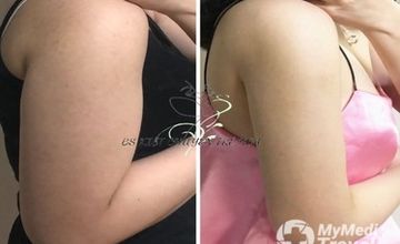 Compare Reviews, Prices & Costs of Urology in An Giang at Home Clinic | FF2A9E