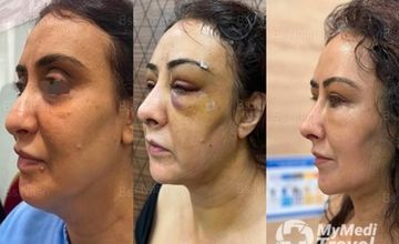 Compare Reviews, Prices & Costs of Gynecology in Ho Chi Minh City at Dr Nhan Ho Aesthetic and Plastic Surgery | 95A177