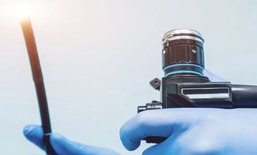 Endoscopic Ultrasound (EUS)