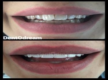 DentOdream / Dental Dream Turkey