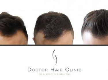 Doctor Hair Clinic - FUE Hair Transplant Clinic Hungary