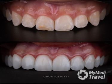 Odontoliuzzi Brazilian Dental Clinic with Excellence