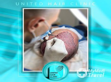 United Hair Clinic