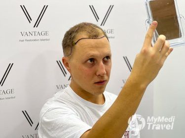 Vantage Hair Restoration