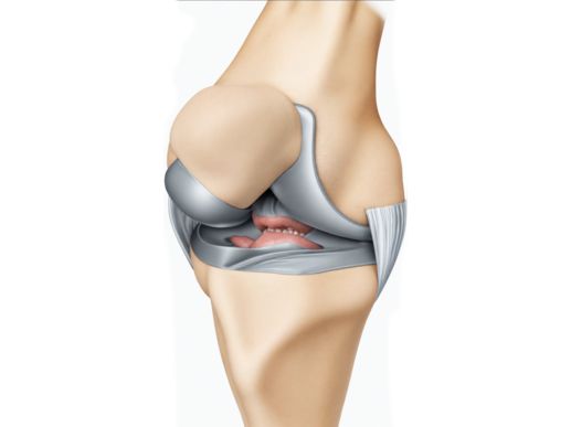 Search and Compare the Best Clinics and Doctors at the Lowest Prices for Knee Ligament Surgery (ACL) in Vilnius