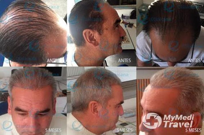 Clinicana Hair Transplant and Esthetic Center