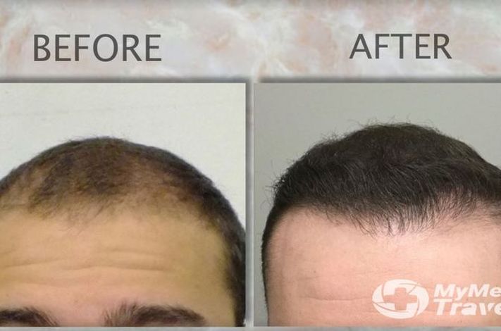 Dr. William Yates. Hair Restoration and MedSpa