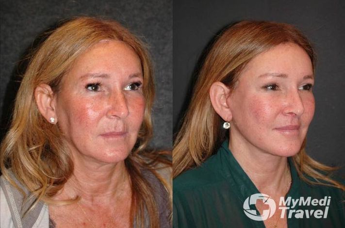 New York Center for Facial Plastic & Laser Surgery