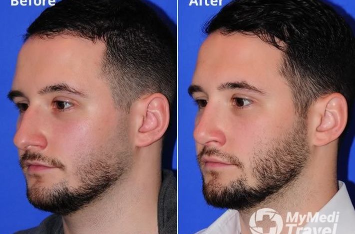 A. Joshua Zimm MD. Facial Plastic & Reconstructive Surgery
