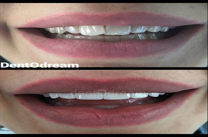 DentOdream / Dental Dream Turkey