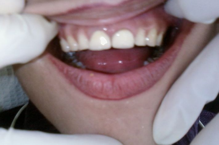 Implant Dental Center Tijuana