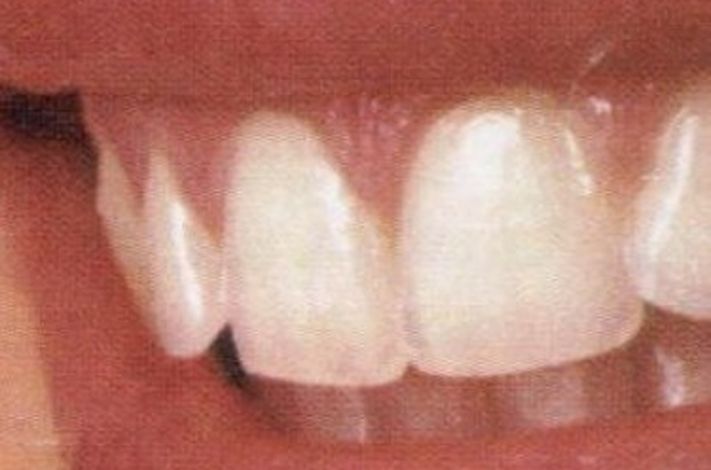 Split Dent Dental Care