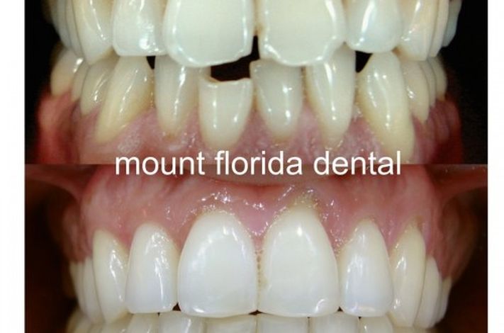 Mount Florida Dental