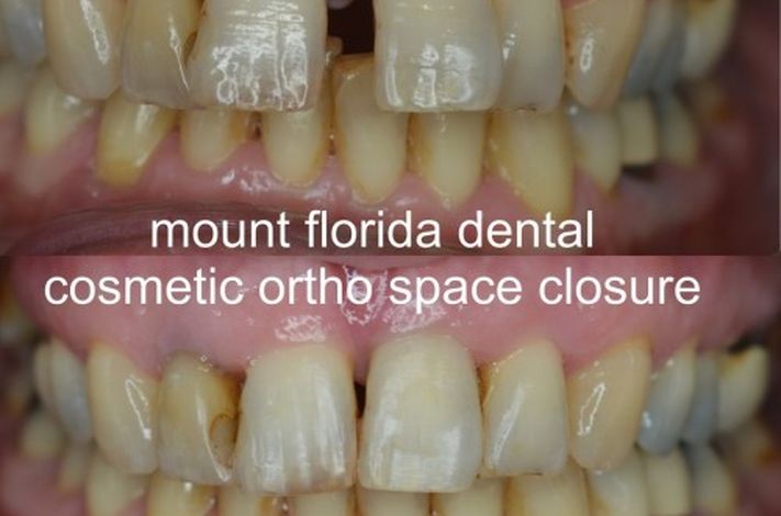 Mount Florida Dental