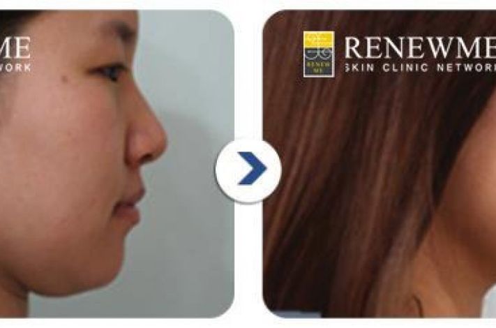 Renewme Skin Clinic