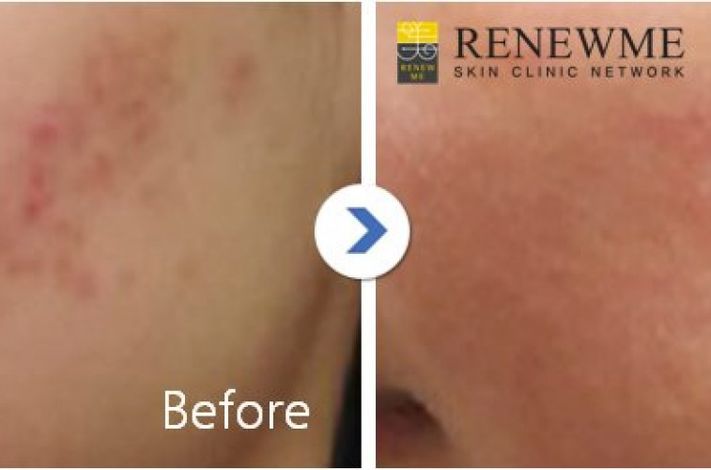Renewme Skin Clinic